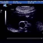 ultrasound03.jpg